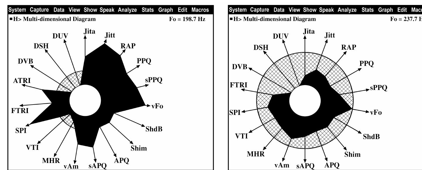Example of a narrow band spectrographic analysis of a
