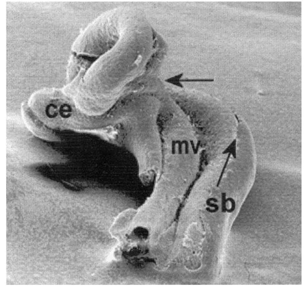 Midgut Rotation Embryo (PDF) The embryology of gut rotation