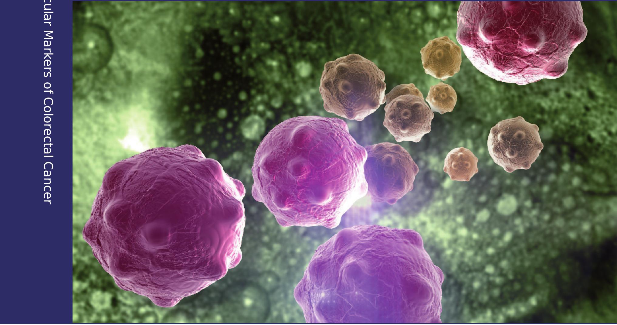 (PDF) Molecular markers alterations in Iraqi patients with colorectal ...