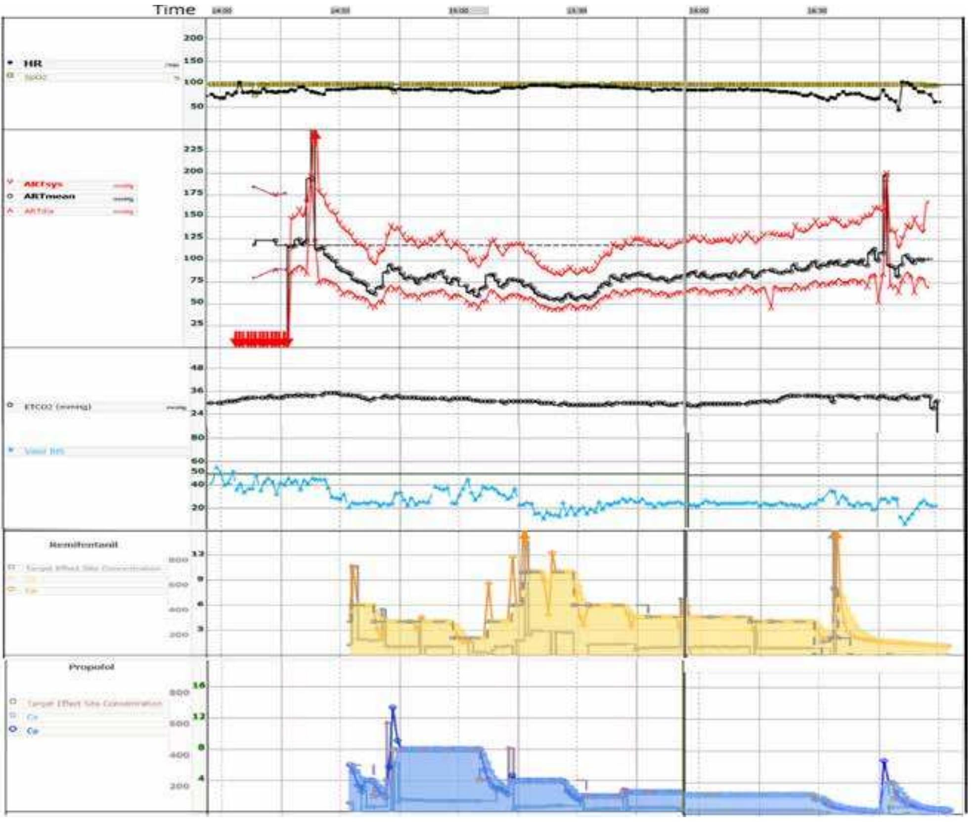 (PDF) The colour density spectral array in the perioperative management ...