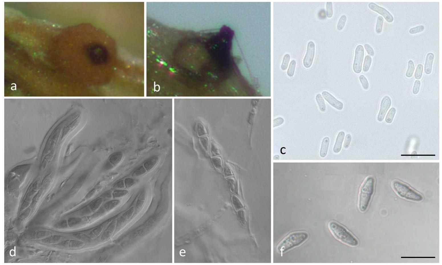 (PDF) Revisiting Stagonosporopsis species associated with chrysanthemum ...
