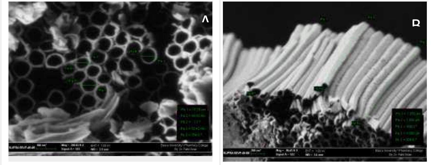 - sem images show (a) top view (b) cross section image of