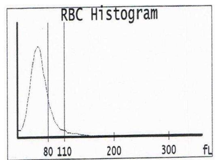 (PDF) Correlation of peripheral smear with RBC indices and RBC ...
