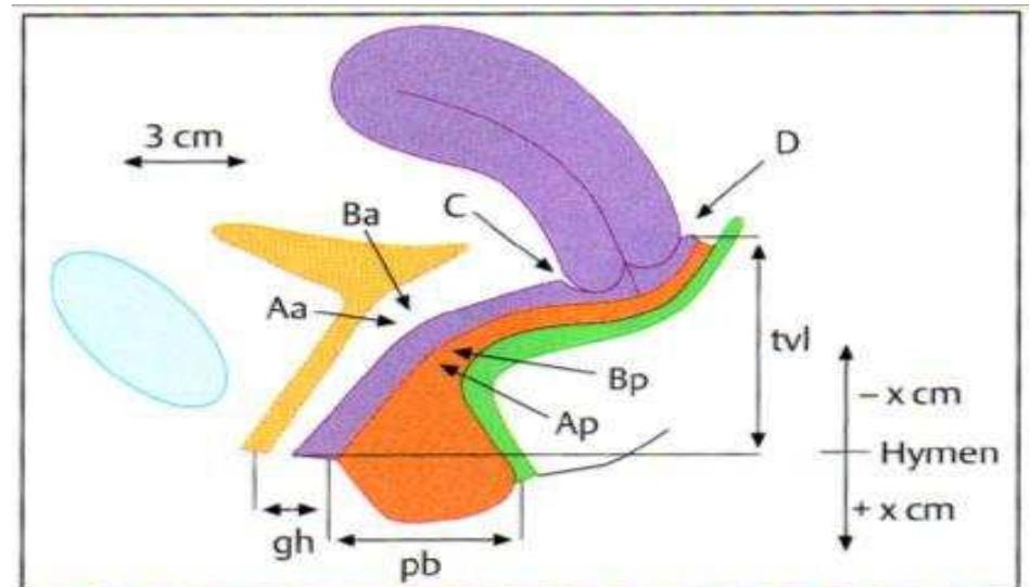 (PDF) Association between the standardized pelvic organ prolapse ...