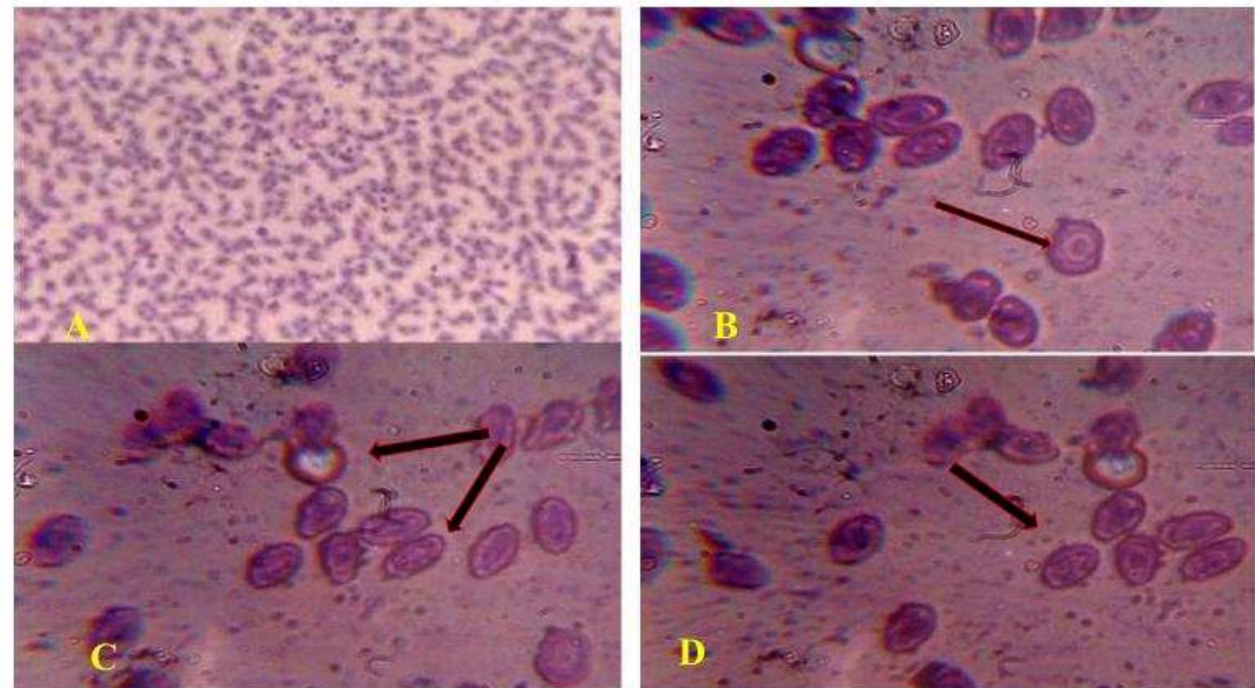 Fish Rbc Illustration A:- showing blood smear of labeo rohita (healthy) (40x), b)