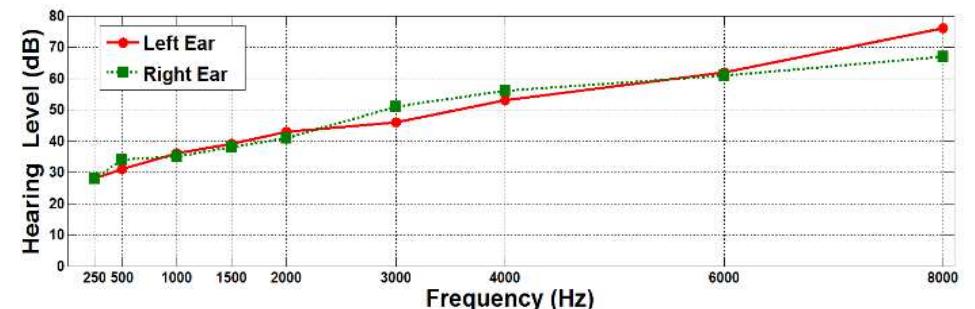 (PDF) Design and Implementation of Software Based Audiometer System