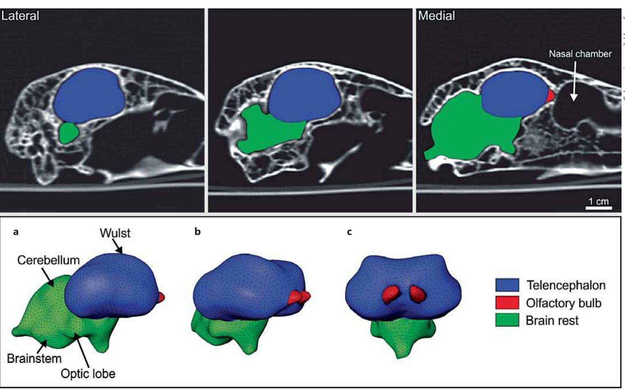 Ct scans of the skull and reconstructions of the brain of a