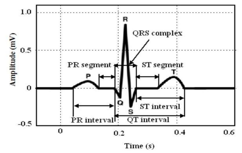 -3: qrs complex of ecg signal now, after effectively