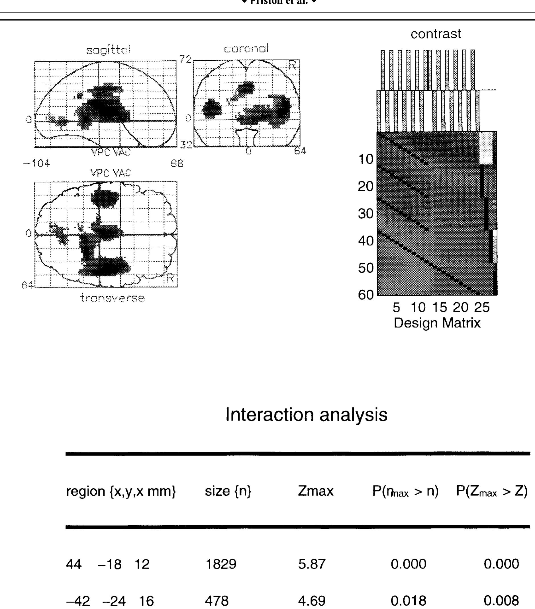 (PDF) Statistical parametric maps in functional imaging: A general ...