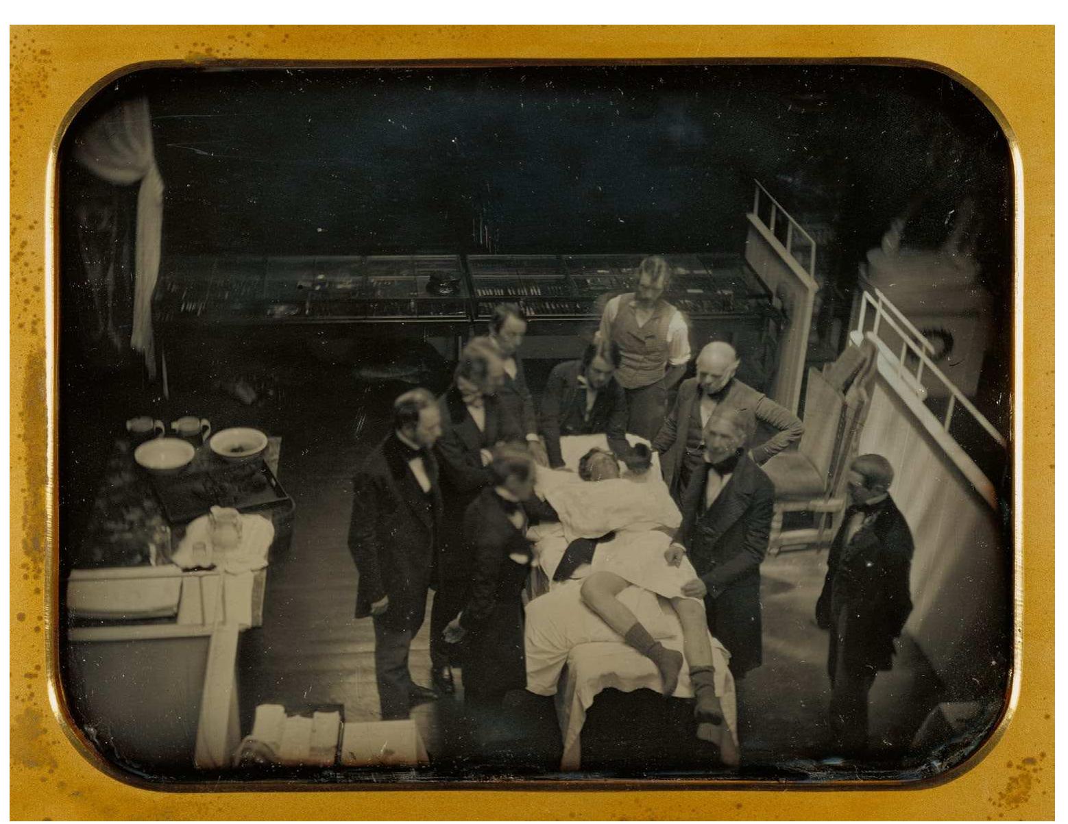 Figure 4. Southworth & Hawes, Early Operation Using Ether for Anesthesia. Daguerreotype, |847. J. Paul Getty Museum, Los Angeles. Digital image courtesy of the Getty Open Content Program. 