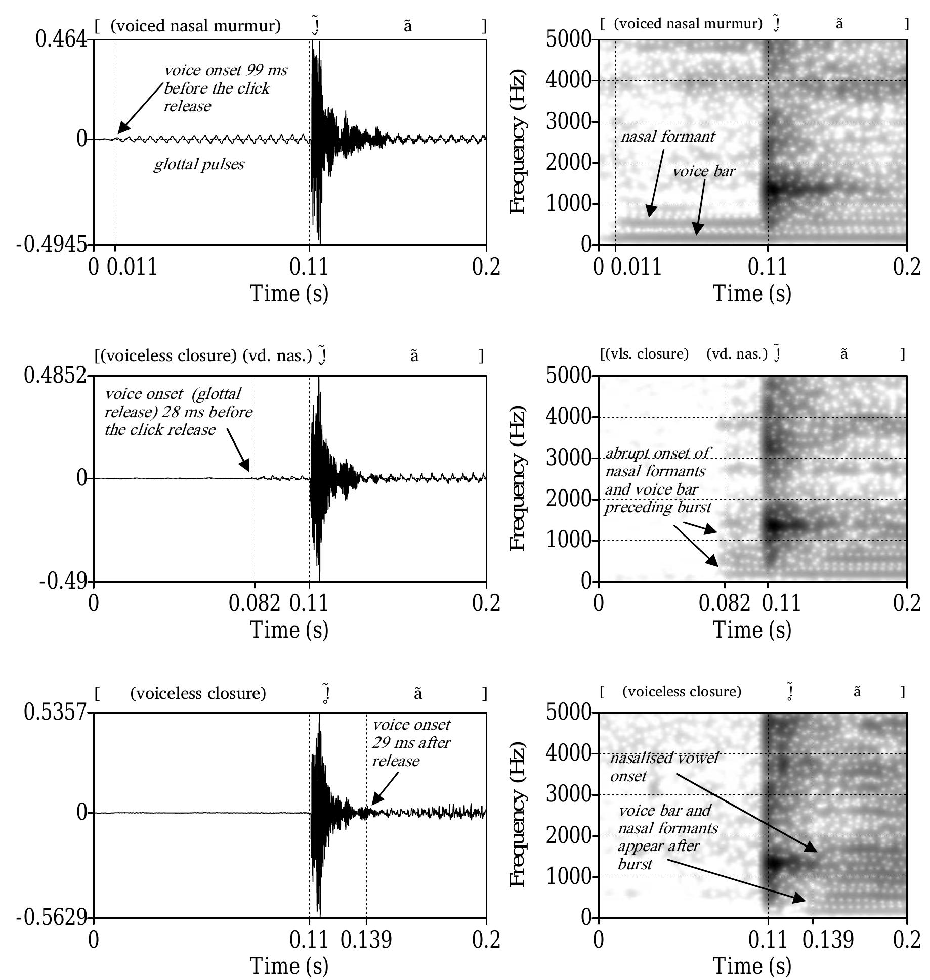 Waveforms (left) and spectrograms (right) of plain nasal