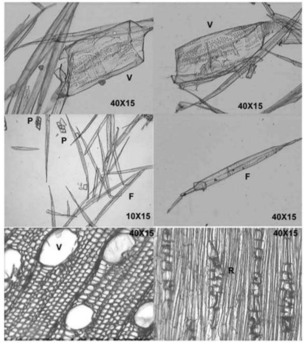 Figure-3: Micrograph of fibers, vessels and parenchyma cells of T. orientalis (Jahan and Mun, 2003) 