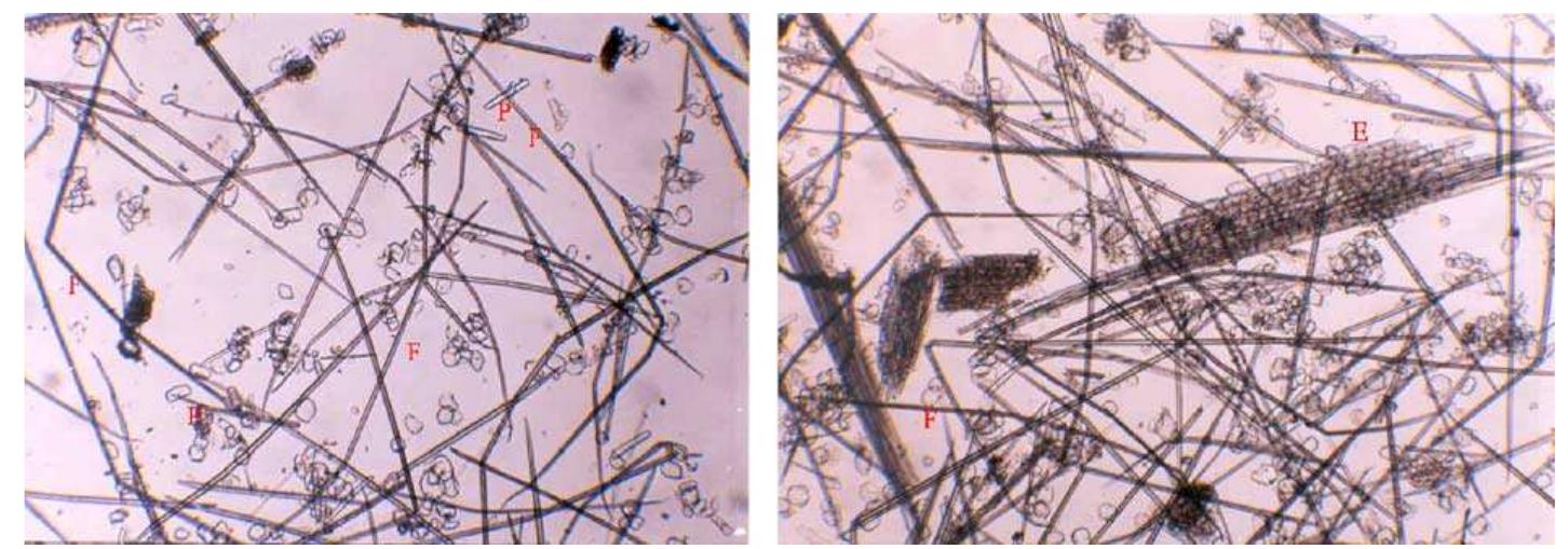 Fig. 3. Macerated sample of golpata fronds (10 x 10), fiber (F), parenchyma (P), epidermis (£).  Table 2 shows the morphological characteristics of golpata fronds and its comparison with wood fibers. 