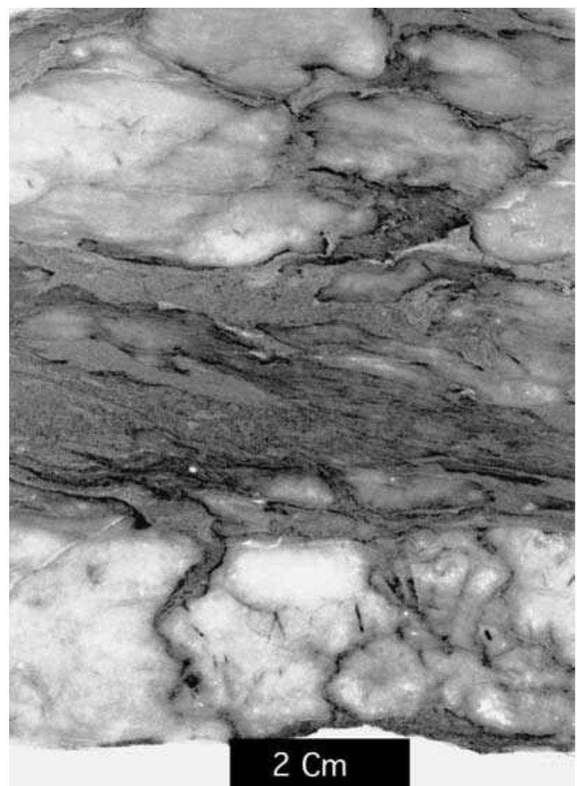 2 nodular anhydrite in a core sample of the buckner