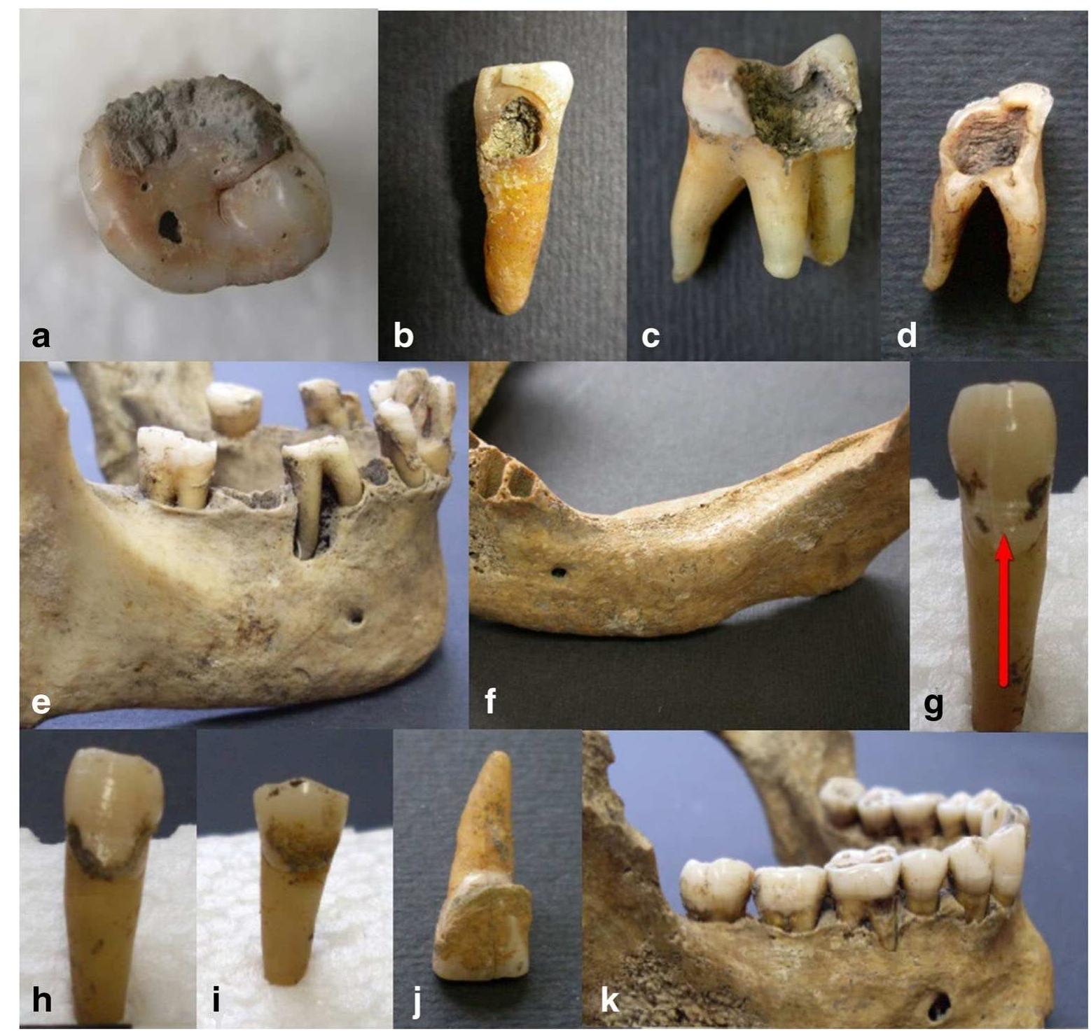Figure 1 - from A combined analysis of dietary habits in the