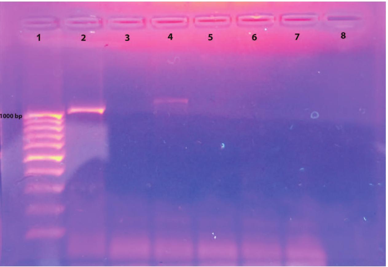 Agarose gel electrophoresis of pcr products amplified from