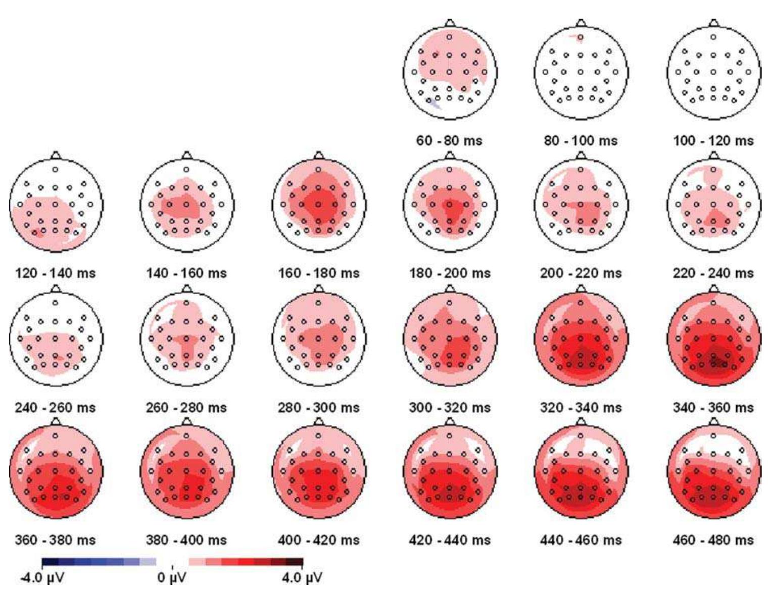 Figure 55 - from COMBINED TMS-EEG STUDIES OF VISUAL