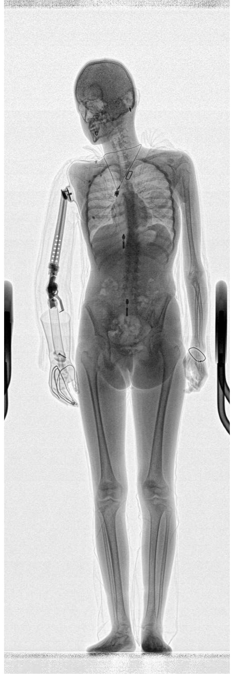 Adoni Body Scanner (PDF) Body scanners versus privacy and data protection