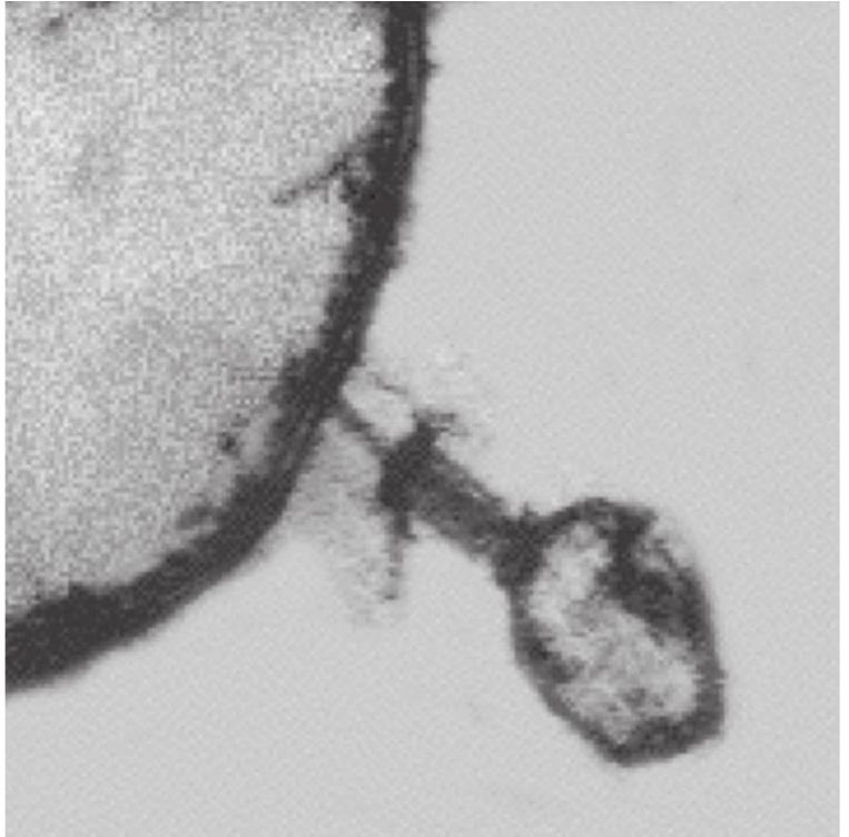 -2 electron micrograph of phage infecting a bacterium.