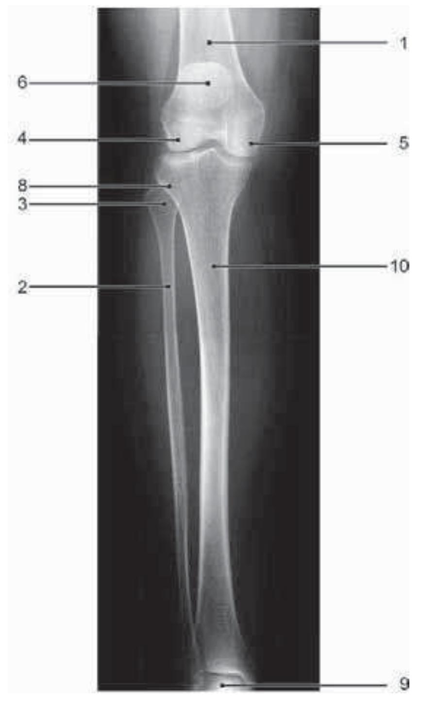 44 leg, ap projection.