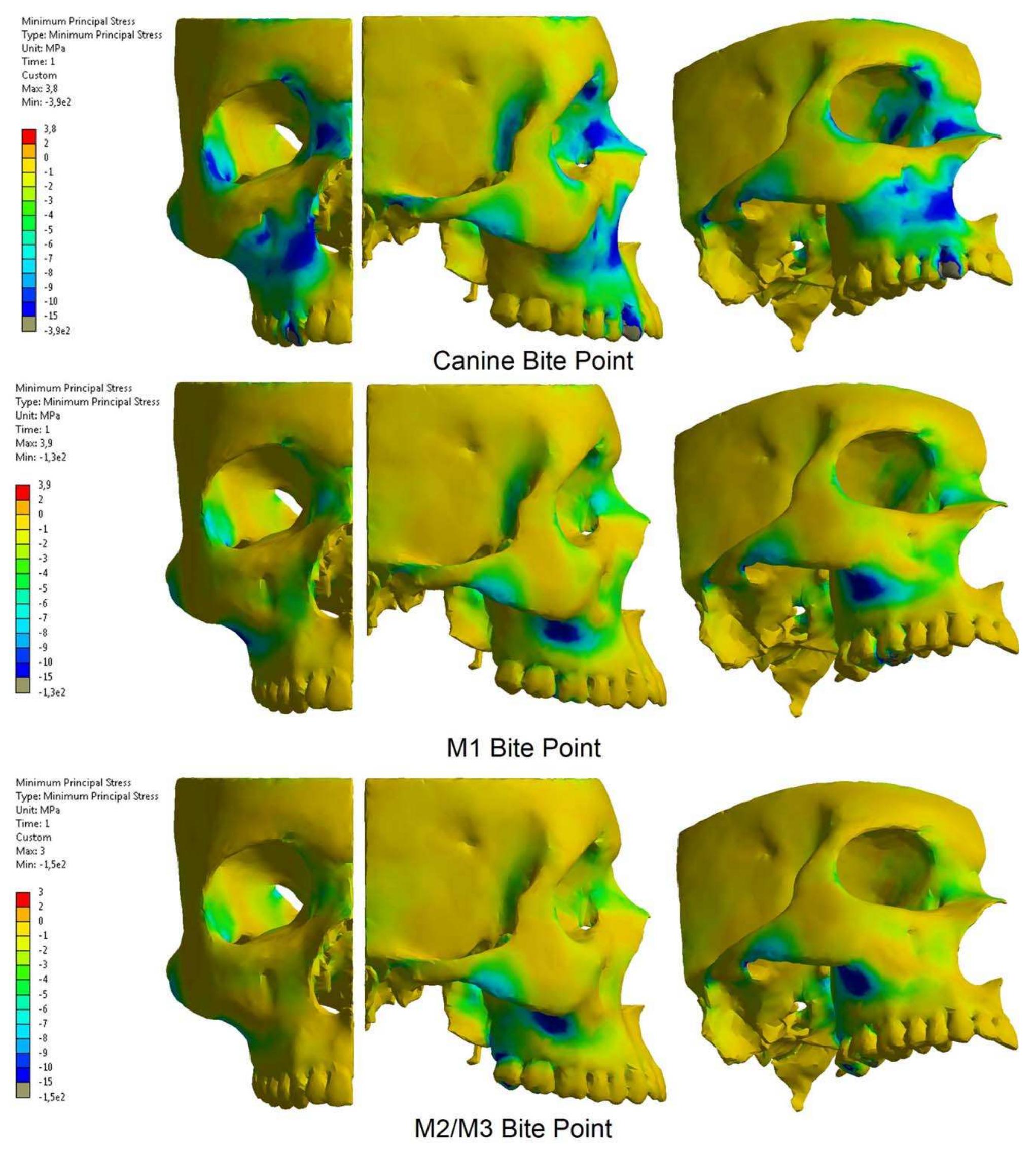 Compressive Stress Distribution Minimum principal (compressive) stress distribution in the
