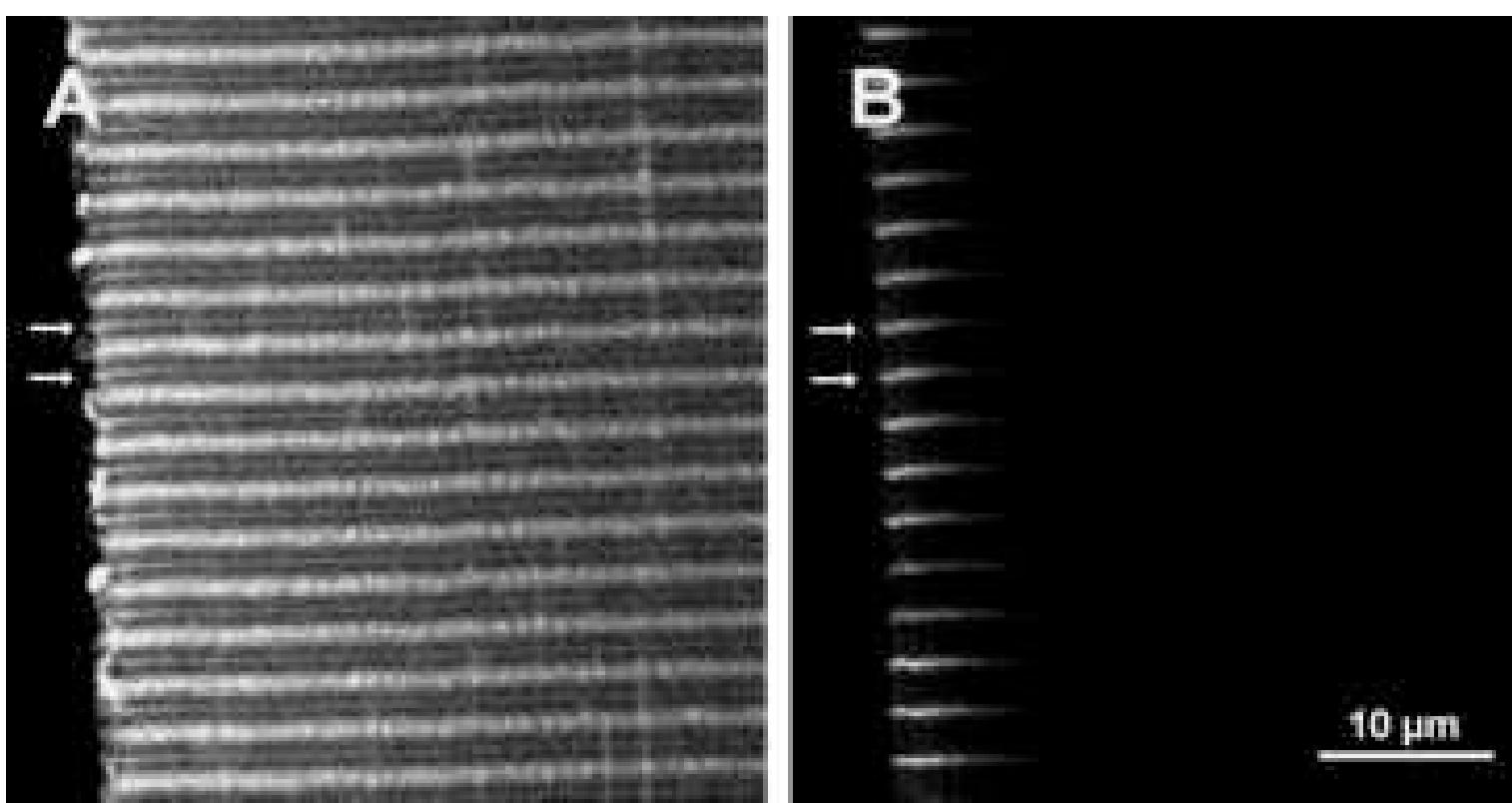(a) confocal image of longitudinal optical section through