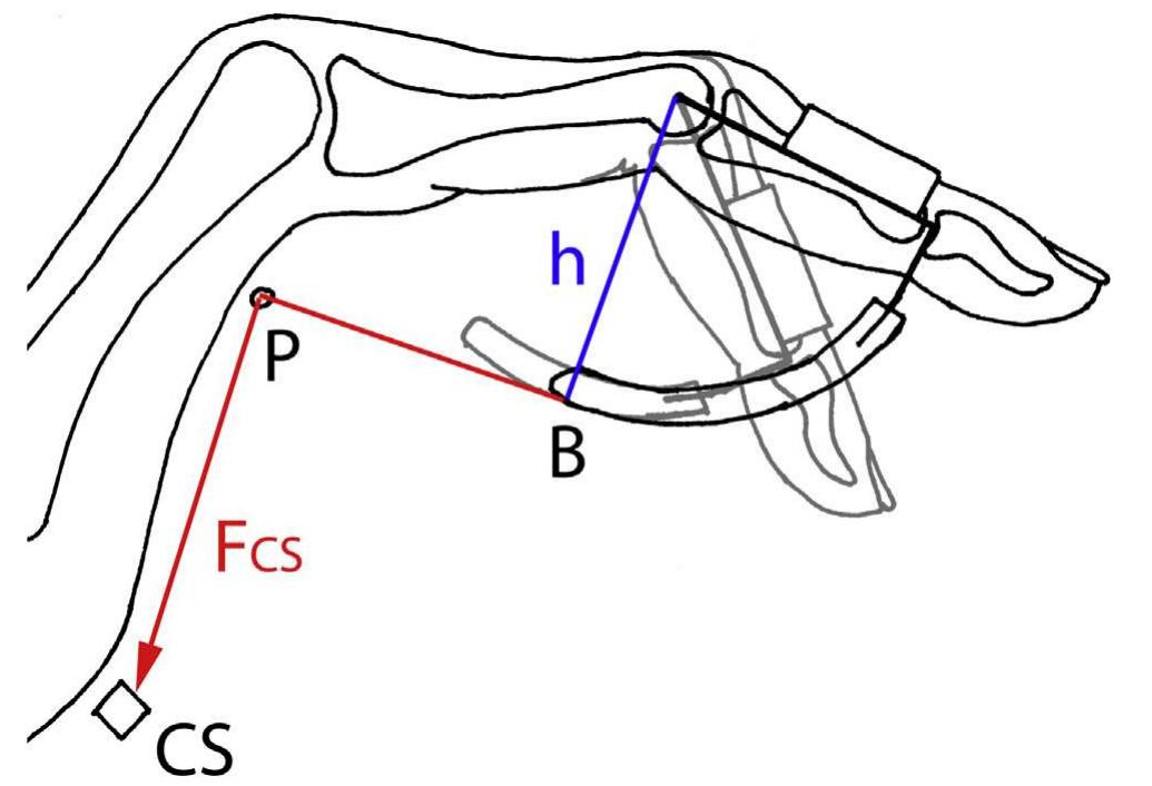 Schematic overview of the isoforce flexion outrigger showing