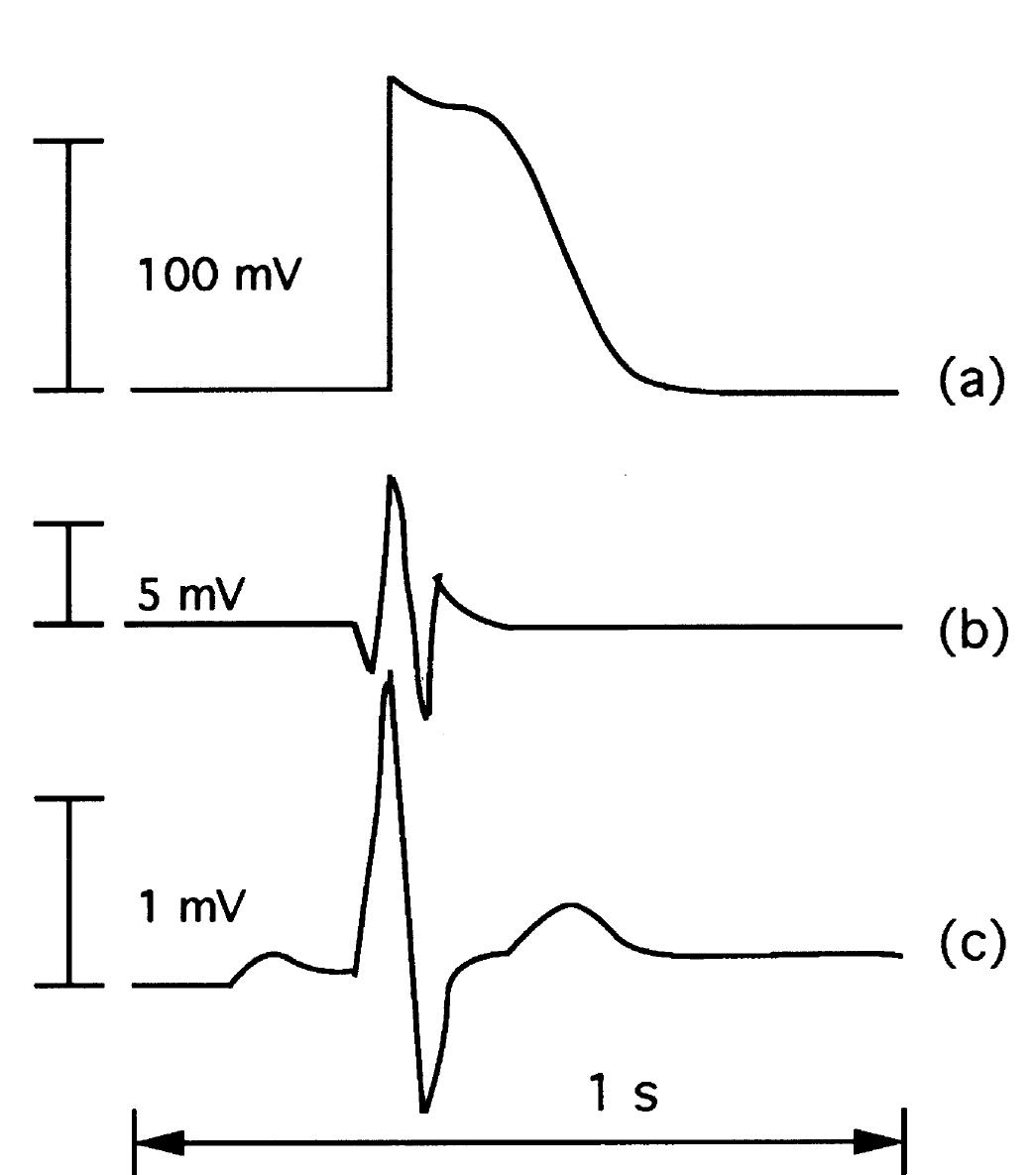 Cellular Electrogram 1 sample waveforms: (a) ecg, normal sinus rhythm; (b) eeg,