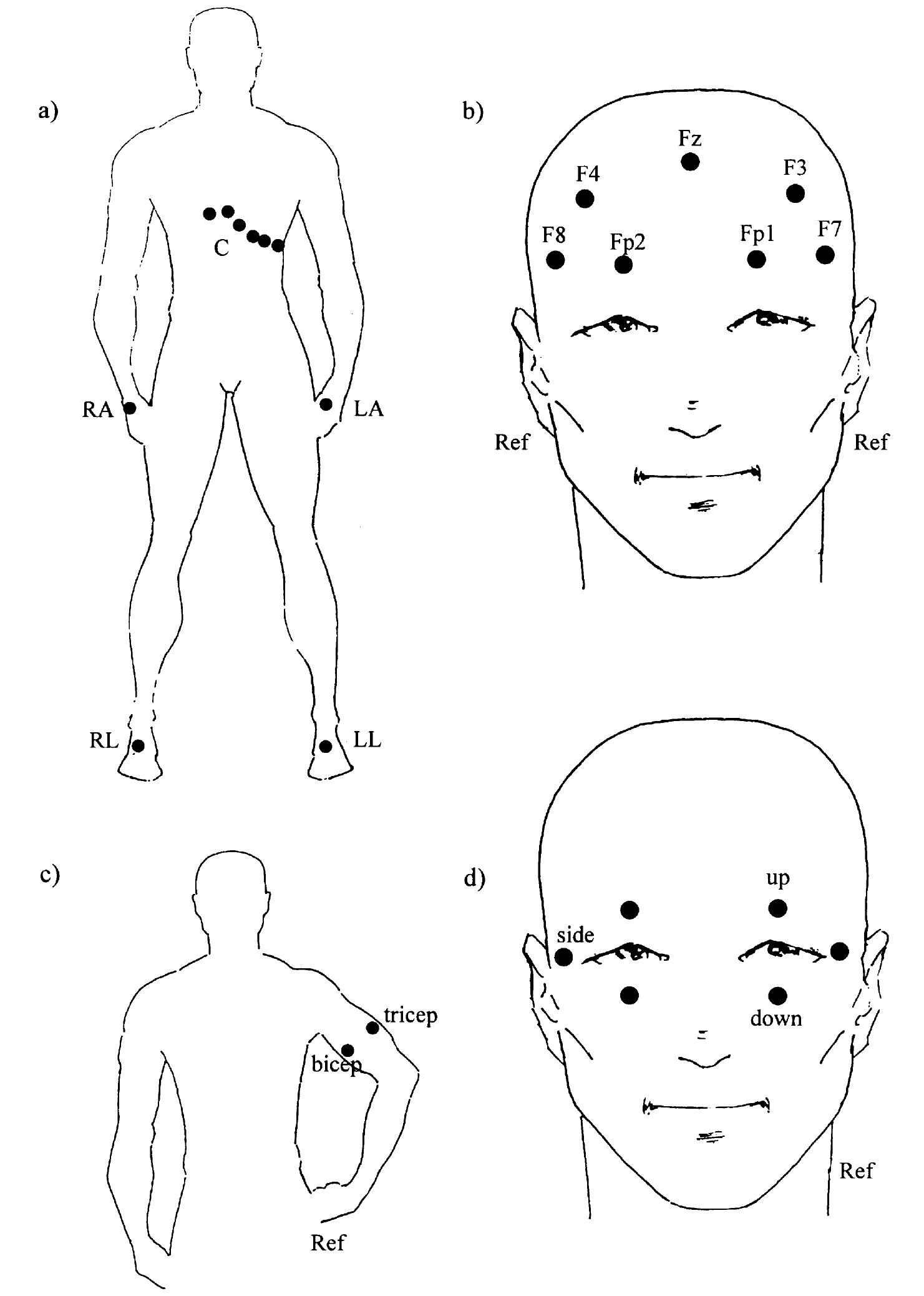 1 sample waveforms: (a) ecg, normal sinus rhythm; (b) eeg,