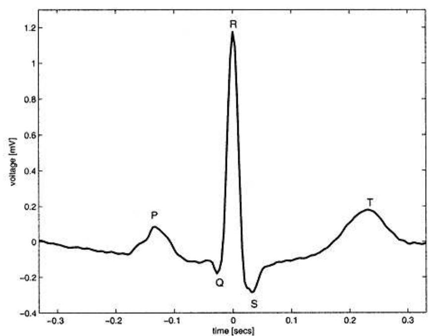 Ekg Rst (PDF) Motion Artifacts and ECG Signal Generation: Literature Review