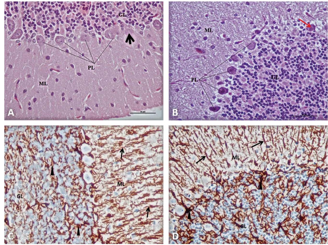 Photomicrographs of the cerebellar cortex from pb and garlic