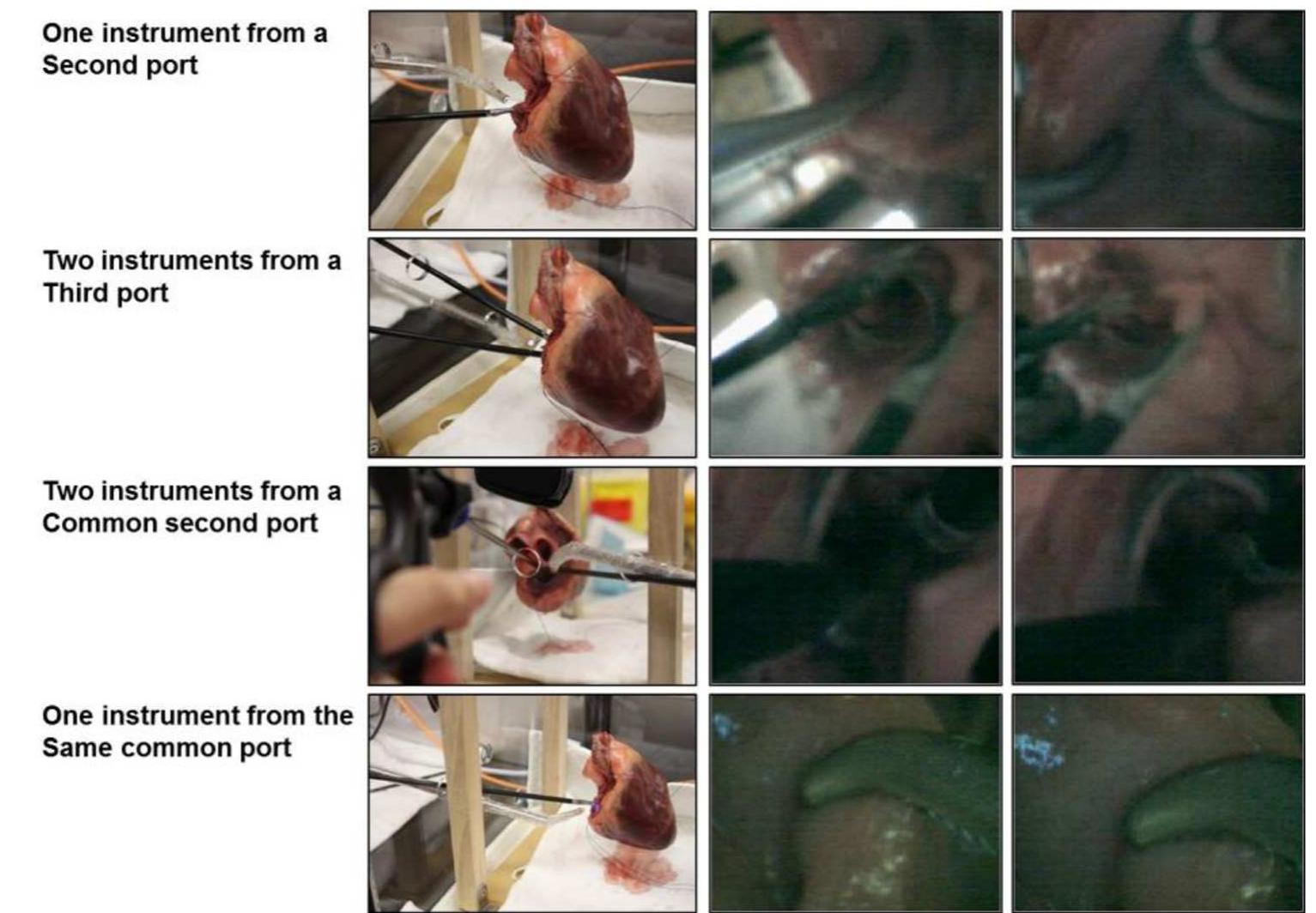 (PDF) Design of a Novel Flexible Endoscope- Cardioscope
