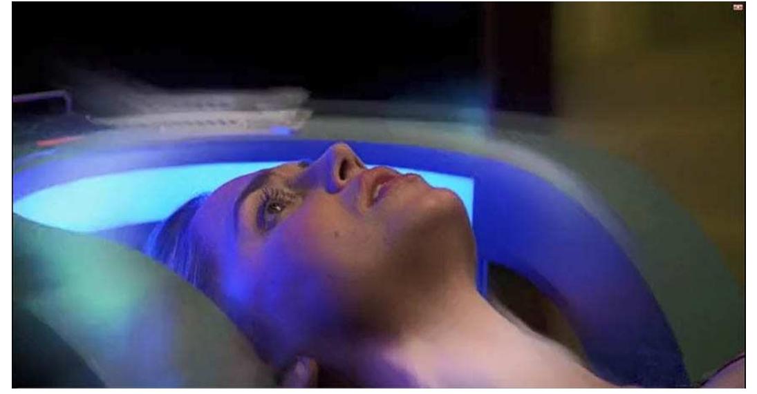 Aamodt and Wang cite the 2004 feature film Eternal Sunshine of the Spotless Mind as an example of a fictional narrative that, like Dollhouse, works with the premise that scientists are able to remove specific memories. Other examples of popular media products that operate with the trope of removing and/or implanting memories include Total Recall (1990), Men in Black (1997) and Dark City (1998). In real life, selective memory alteration might be useful in treating afflictions like Post-Traumatic Stress Disorder (PTSD).’ However, work in this field currently involves cognitive therapy and/or medicinal treatment rather than the type of outright electronic mindwipes common to fictional narratives.  Figure 2: The mind wipe is underway: the technology used to wipe minds in Dollhouse is wireless and physically non-invasive. This becomes an important plot point later in the series, as the technology is weaponized. See Dollhouse, Season 1. Episode 1: ‘Ghost”. First broadcast 13 February 2009. 