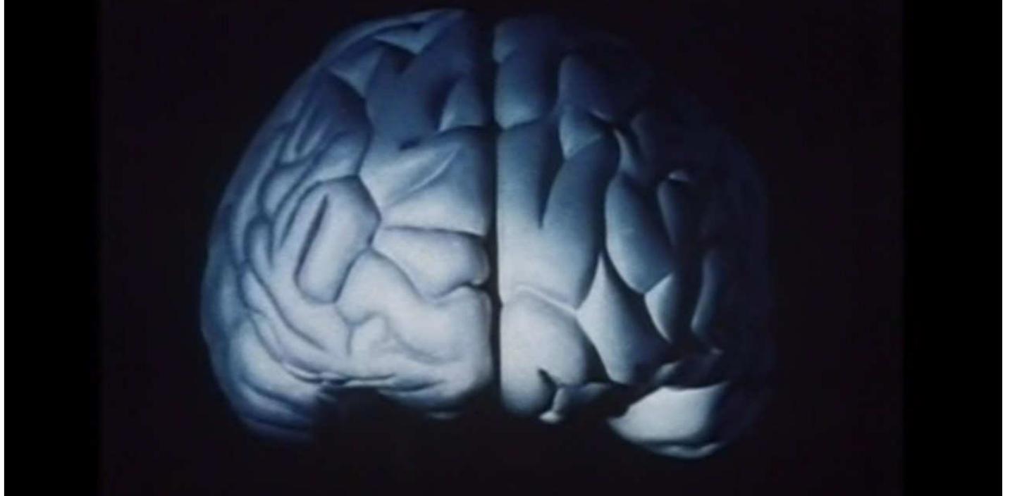 Figure 4: This is a common illustration of the brain in the popular science documen- tary series Human Brain (1983, BBC). Compared to representations of scanning techniques in the more recent documentary series Brain Story, this illustration does not have the same scientific authority, since it cannot be used by medical expertise to reveal “secrets” within the visualisation.  Brain Images and the Human Brain in the 1980s  RAMEN DA Sy LU ALINE V¥ LiCl VL LIL  AGA LI USbhd LY UULULLTILIIIIY It do 110i tid lO LIN VEL VAP ADIL te  As mentioned, previous research has pointed out how this manner of presenting  brain scans as a kind of p  hotographic snapshot provides the general public with  an inaccurate impression of the capacity of scanning techniques (cf. Dumit 2004, Abi-Rached & Rose 2010). While the framing of brain scanning techniques as a  way of “seeing” an individ  ual’s feelings, experiences or characteristics may be an  intriguing narrative within popular media, it also has problematic consequences  for the discursive logic o visualized and narratively  f the (dis)able(d) brain. In Brain Story, Sines’ brain is defined as different. In this way, the brain becomes an  object of ontological difference, placed in an evaluative ranking of other (dis) able(d) brains. This is an example of the strategy Fiona Kumari Campbell (2008) calls sameness, and that leads us to a form of “violence of normalization” where  popular neuroimaging cla brains” (Dumit 2004).  ims to enable a distinction between different “kinds of 