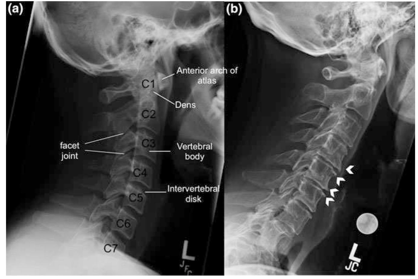 Figure 26 - from Spinal Imaging and Image Analysis