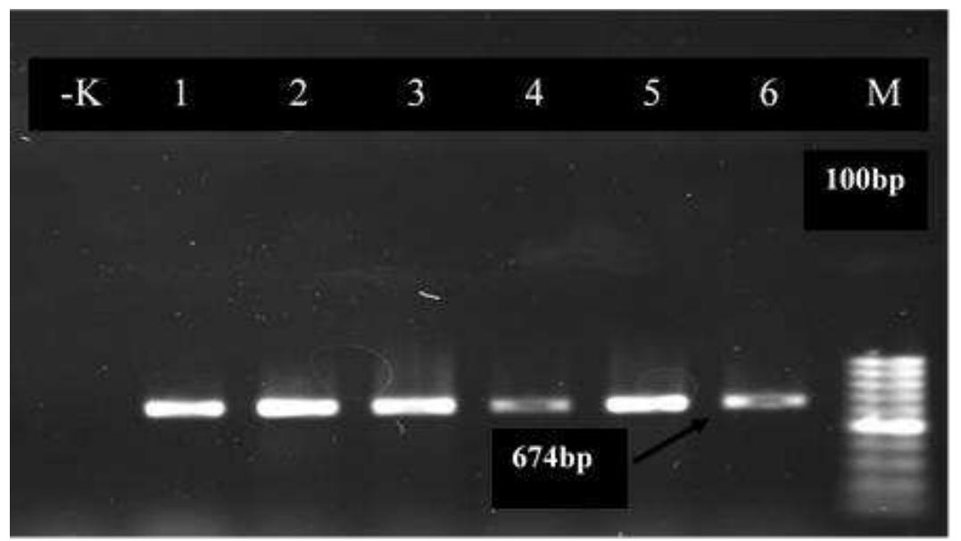 A total of 2% of agarose gel electrophoresis of pcr products