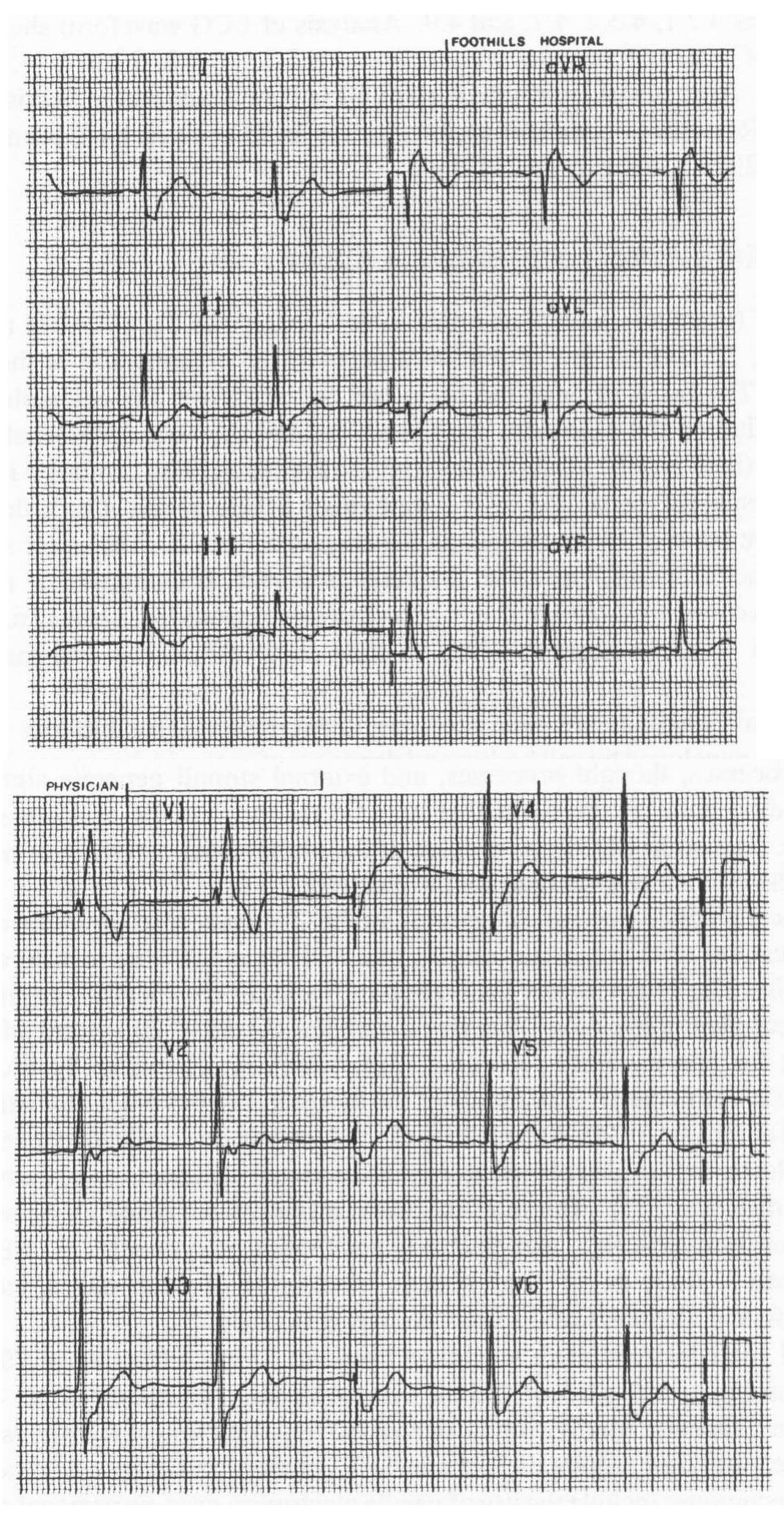 PDF) B 1 0 M ED I CAL SIGNAL ANALYSIS A Case-Study Approach
