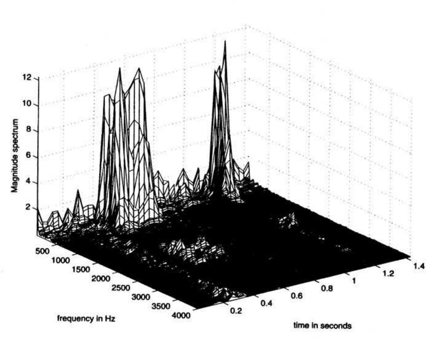 LIMIT OVER COLLECTION -RIVALS- 、スペシャルパック PDF) B 1 0 M ED I CAL SIGNAL ANALYSIS A Case-Study Approach