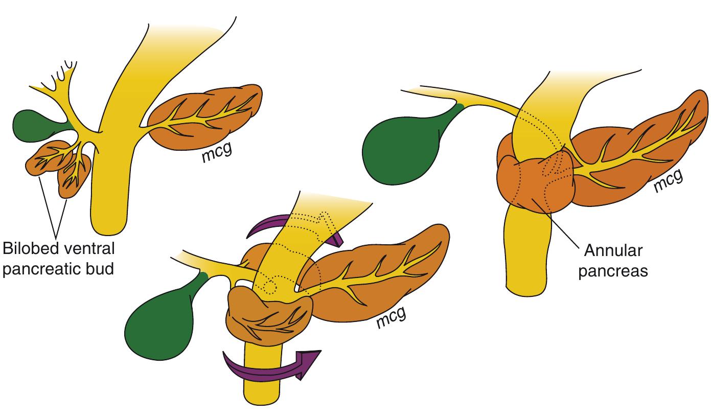 Figure 49 - from Handbook of pediatric surgery