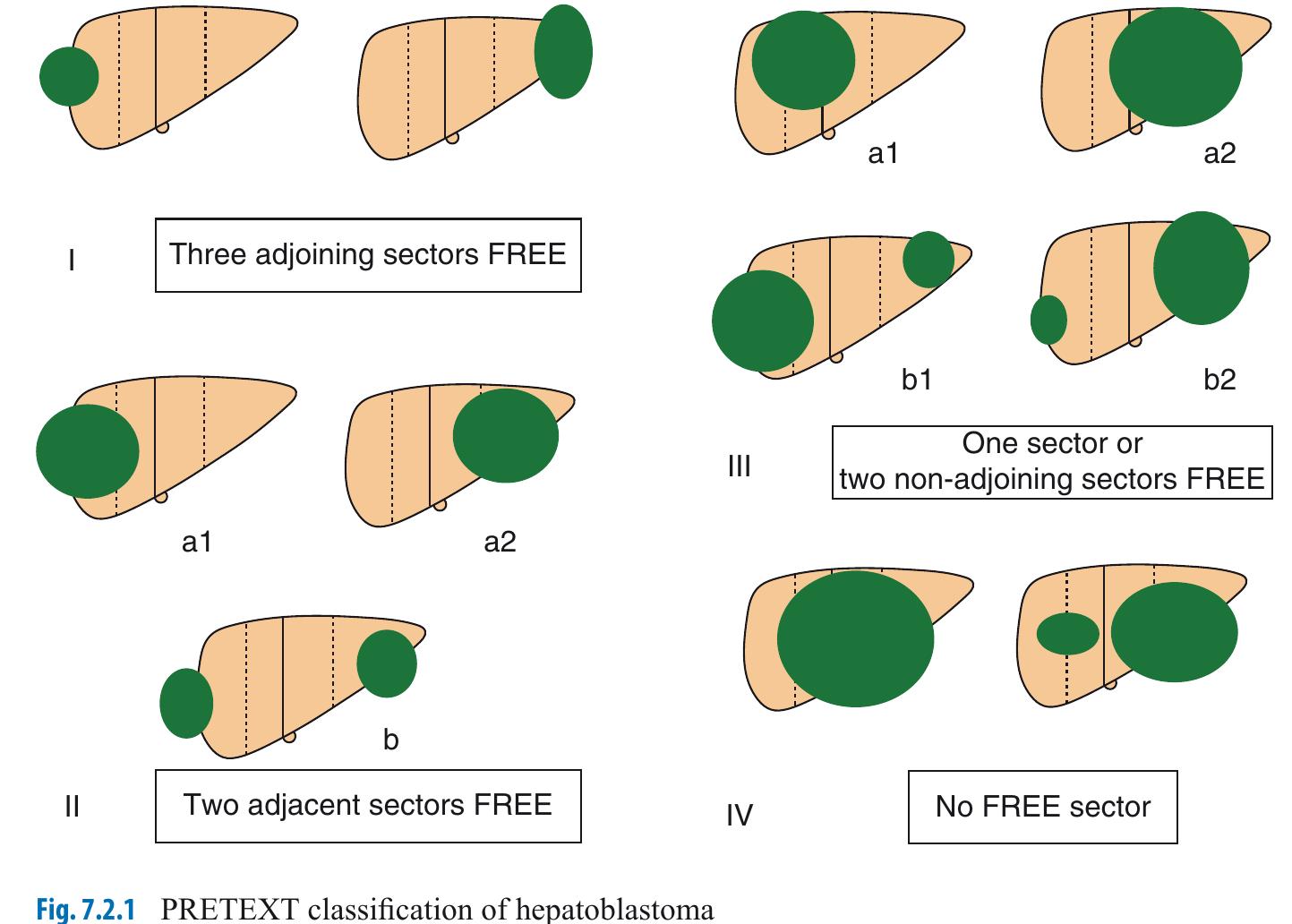 Pretext 3 (PDF) Handbook of pediatric surgery