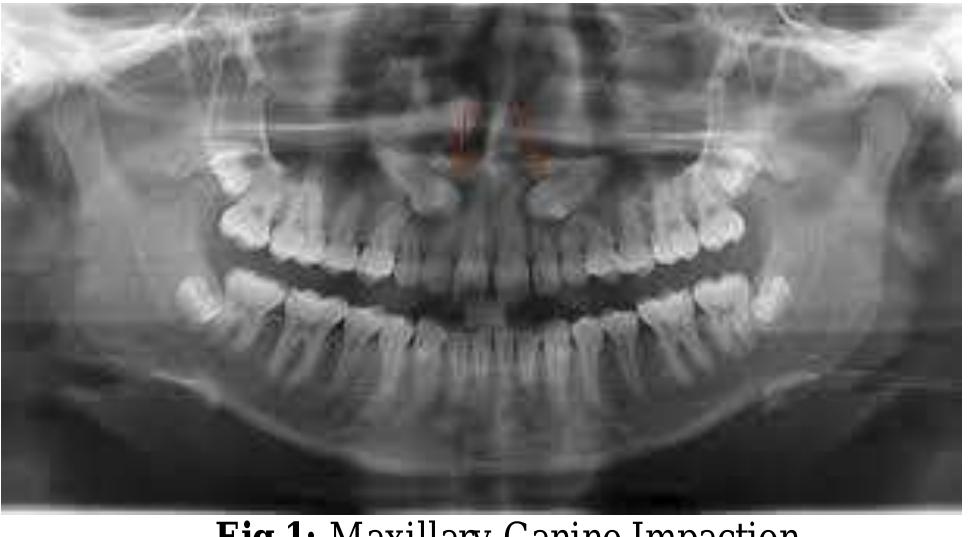 Figure 1 - from A review of the diagnosis and management of