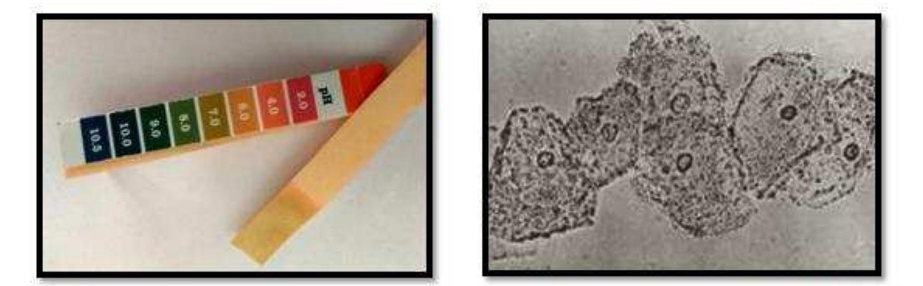 Wet mount showing clue cells 40x quot cytological findings of