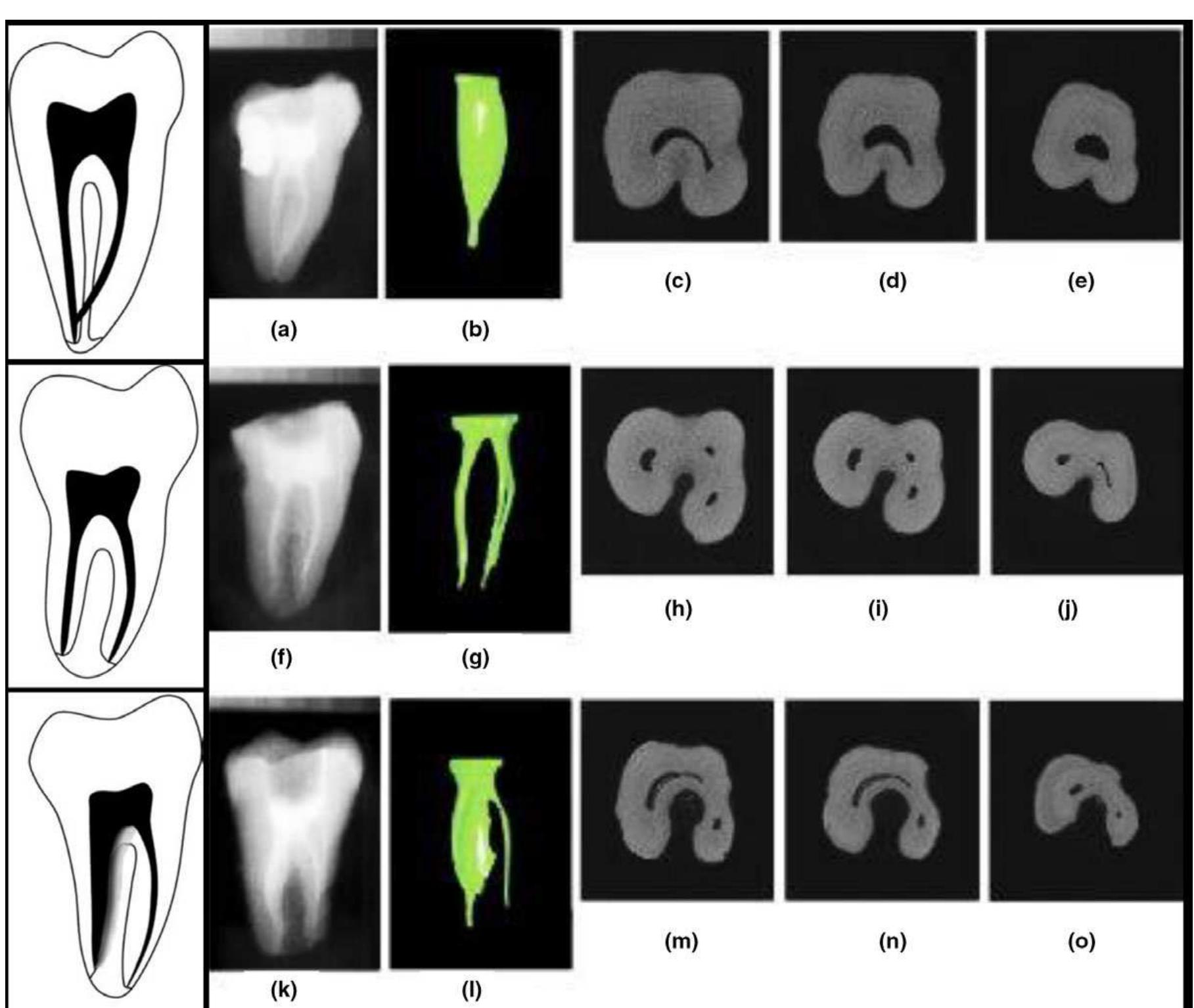 Figure 6 - from A new system for classifying tooth, root and