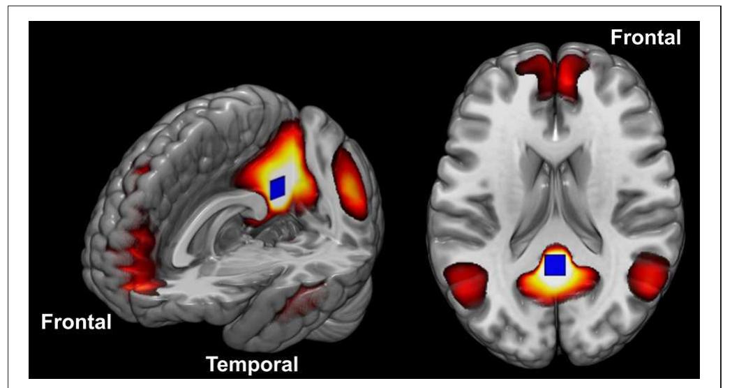 Figure 1 - Differences in Cortical Structure and Functional
