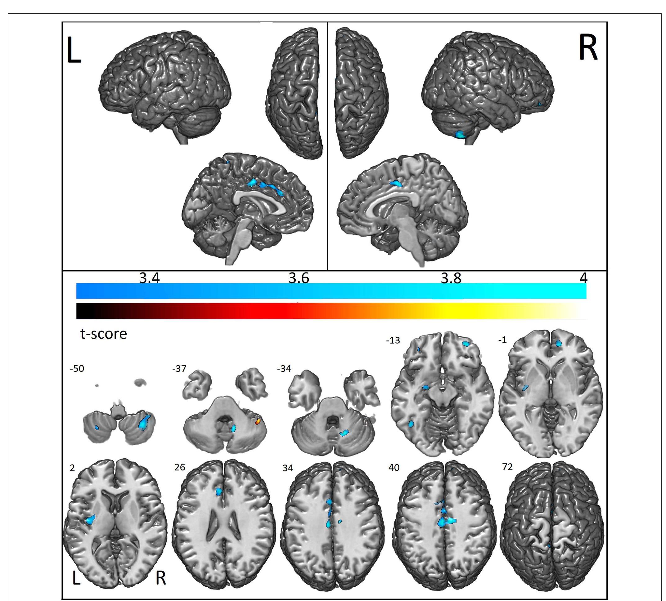 Figure 1 - Differences in Cortical Structure and Functional
