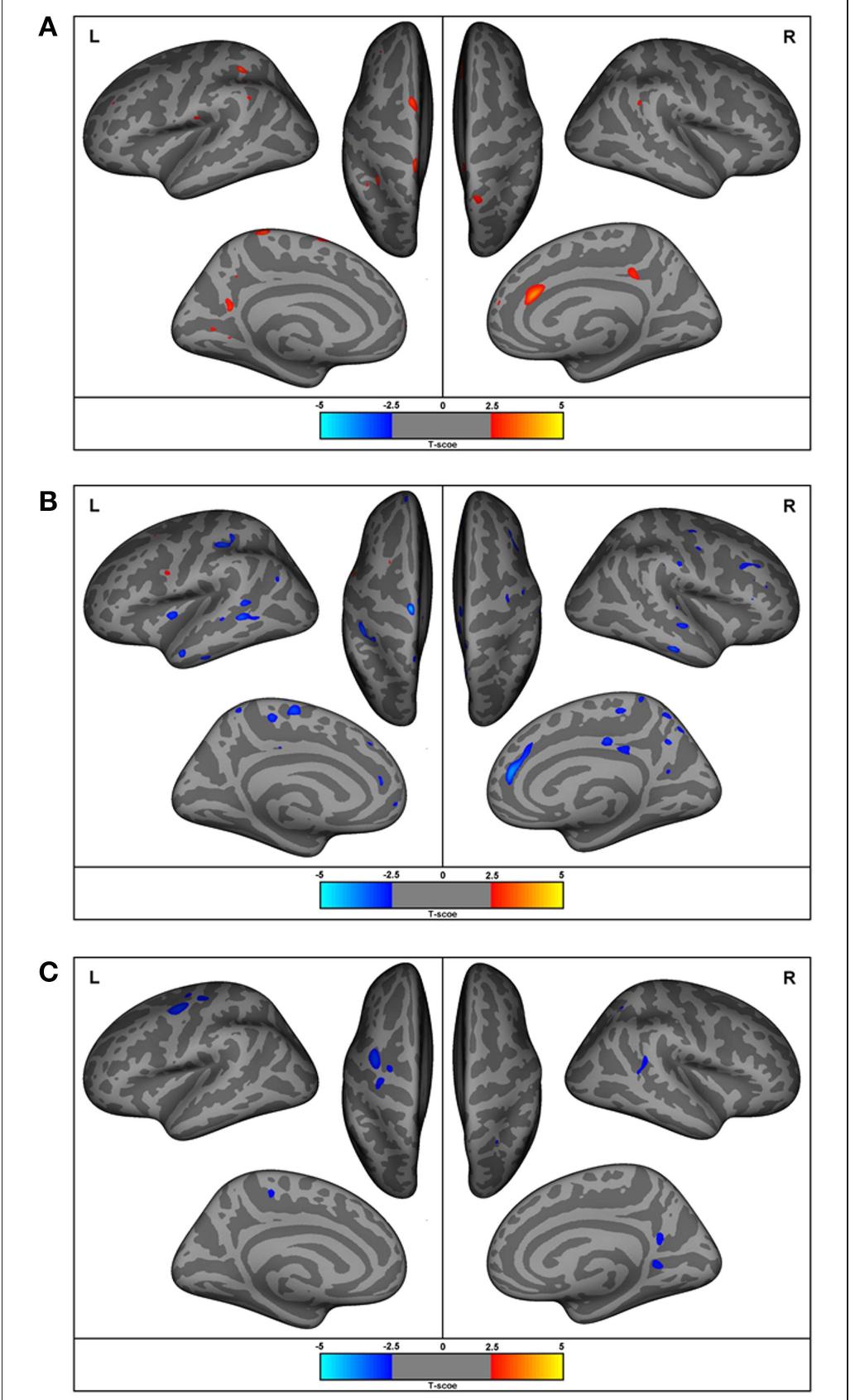 Figure 1 - Differences in Cortical Structure and Functional