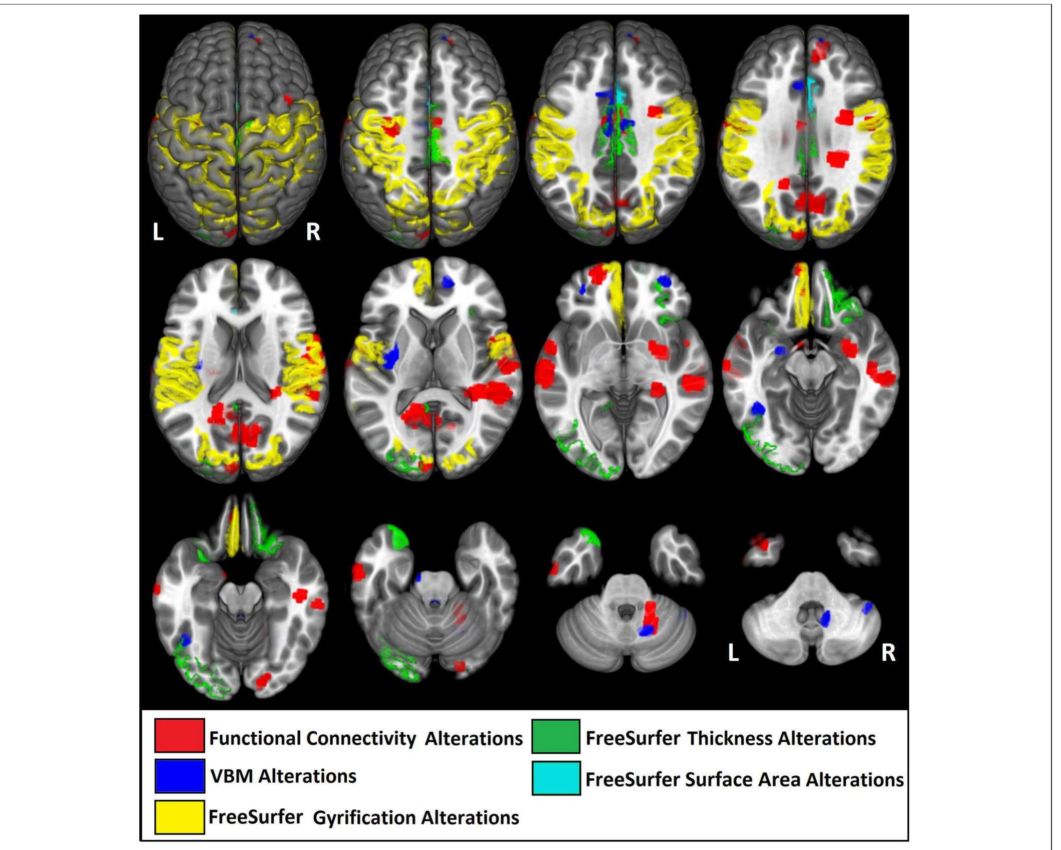 Figure 1 - Differences in Cortical Structure and Functional