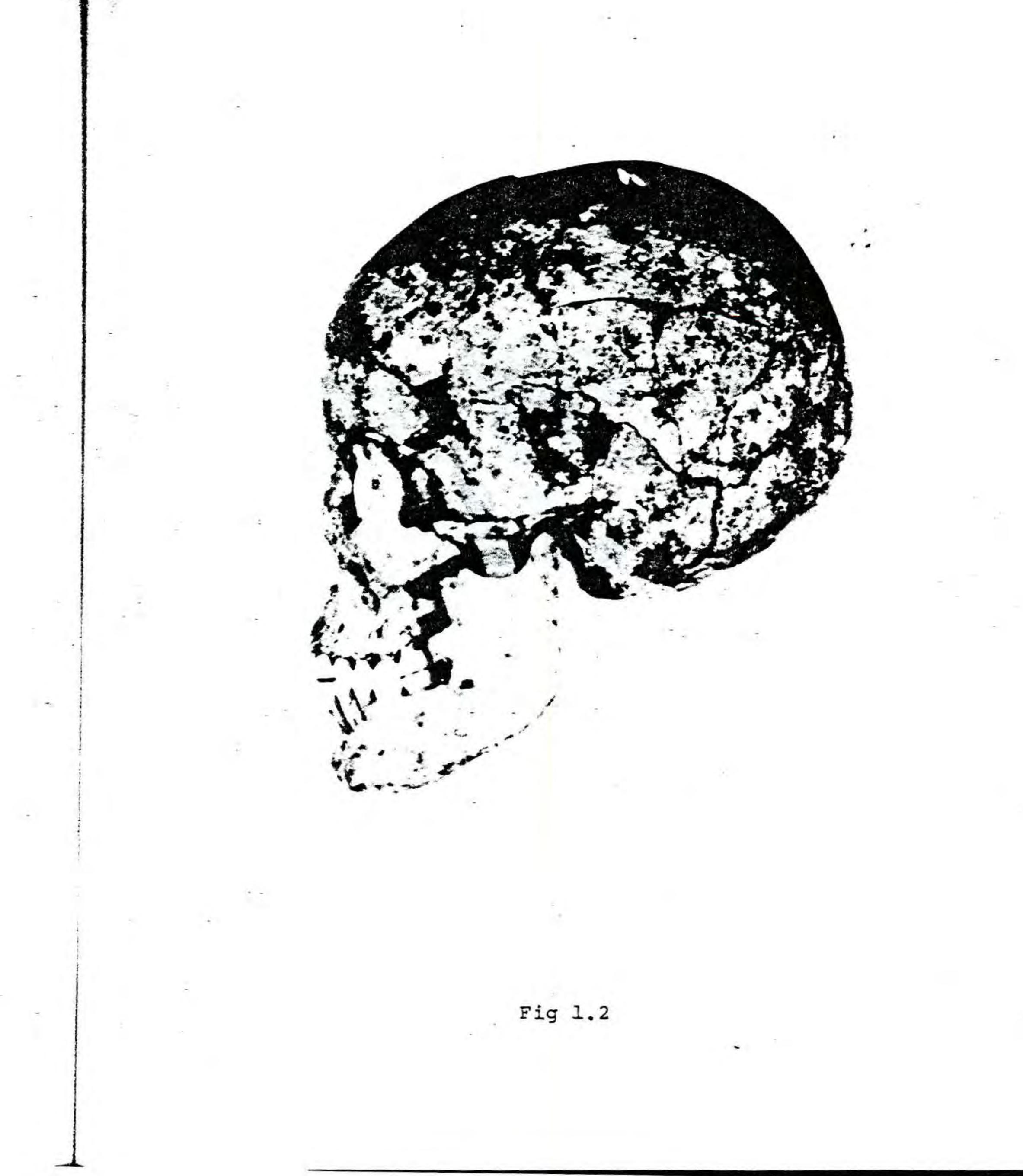 PDF) Non Nok Tha: the human skeletal remains from the 1966