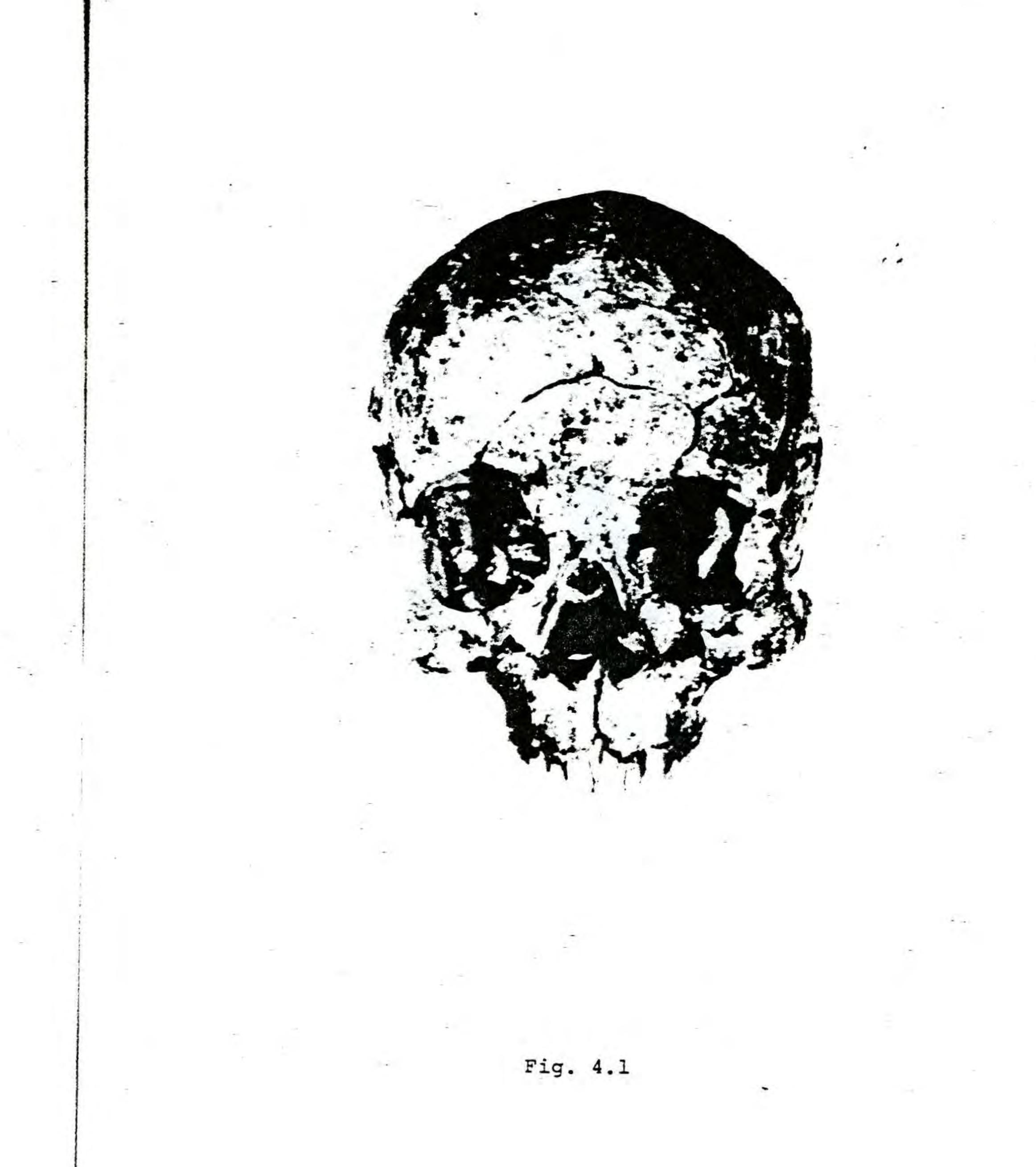 ミィ 荒１５キロ Maison MIHARA YASUHIRO ONLINE STORE（ミハラヤスヒロ