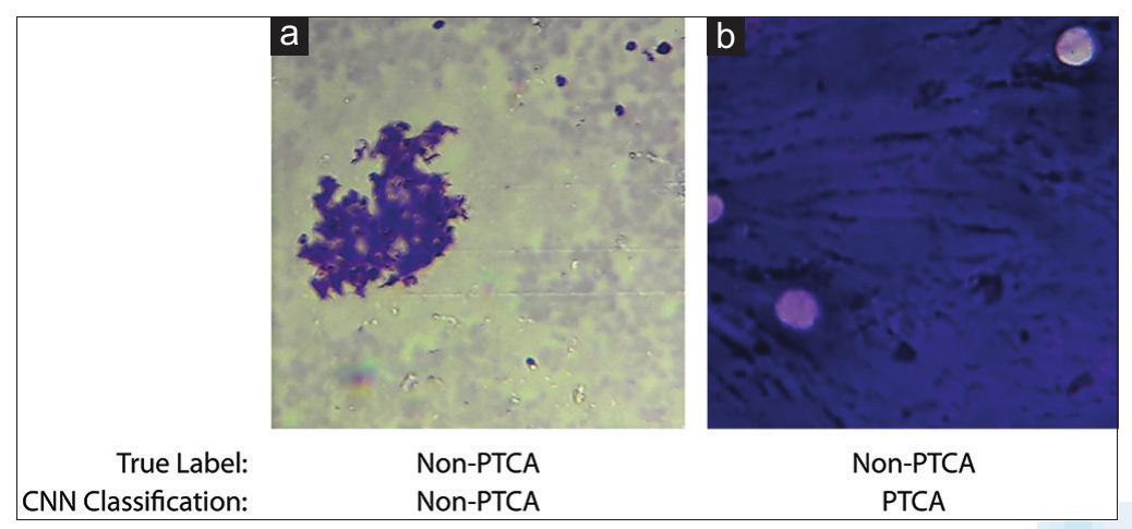 Examples of true and false classification by the